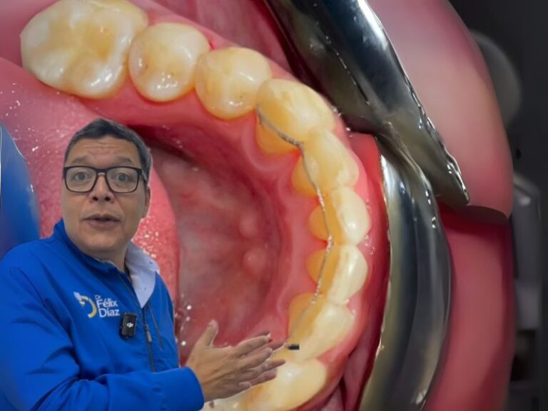 Dr. Félix Díaz, odontólogo en Caracas, explicando tratamiento de ortodoncia previo a implantes dentales