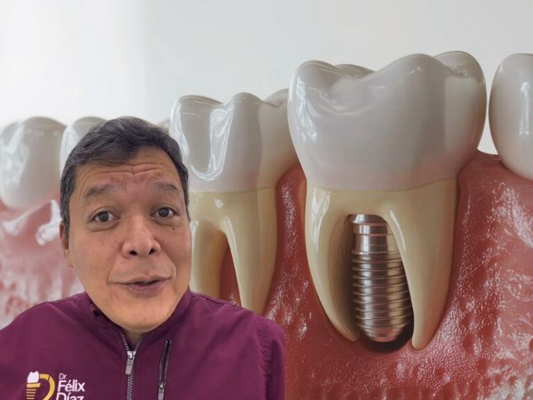 Dr. Félix Díaz explicando implantes dentales en Caracas y conservación de dientes naturales