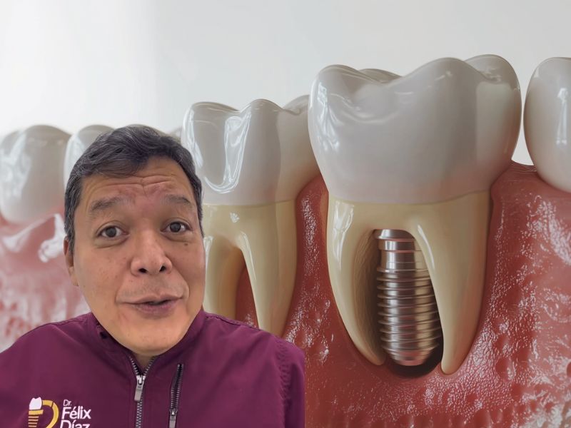 Dr. Félix Díaz explicando implantes dentales en Caracas y conservación de dientes naturales