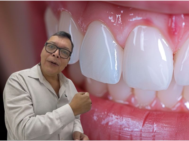 Encías inflamadas después de un tratamiento dental: lo que realmente determina su evolución