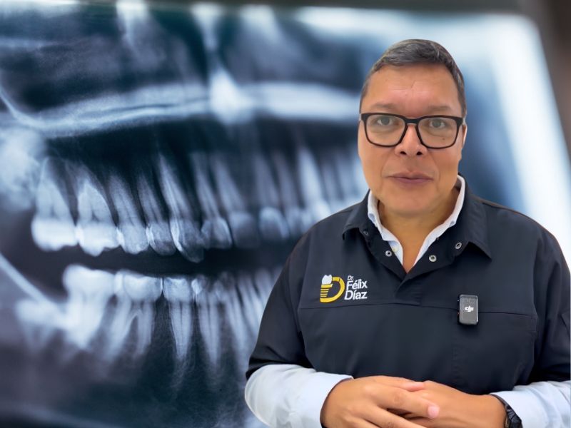 Dolor Nasal por un Diente: Cómo Descubrieron un Quiste Gigante en Caracas