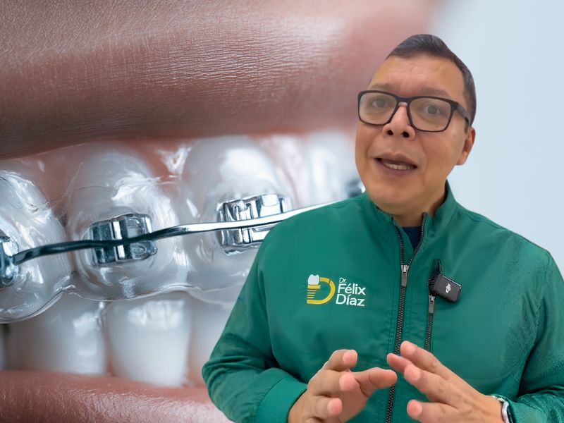 Ortodoncia en Caracas: No Todo el que Coloca Brackets Es Ortodoncista