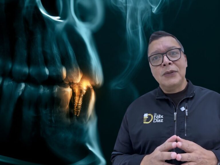 Dr. Félix Díaz explicando los riesgos de implantes dentales en fumadores, con radiografía del implante