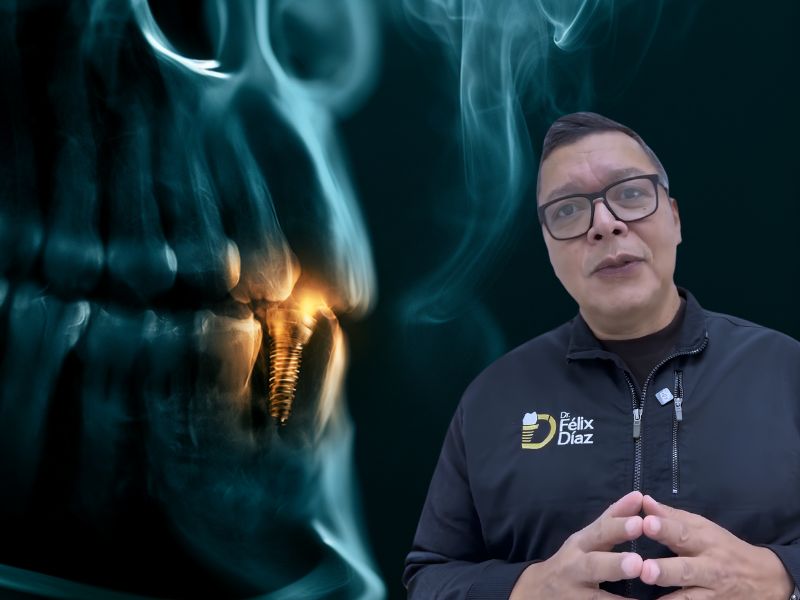 ¿Puede un fumador someterse a un implante dental? Riesgos reales y qué puedes hacer