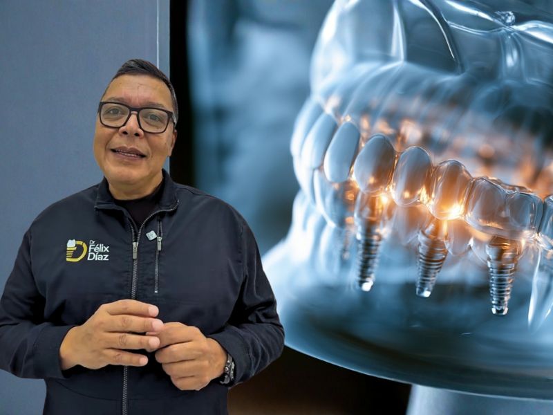 ¿Te imaginas salir de cirugía con implantes fijos el mismo día?